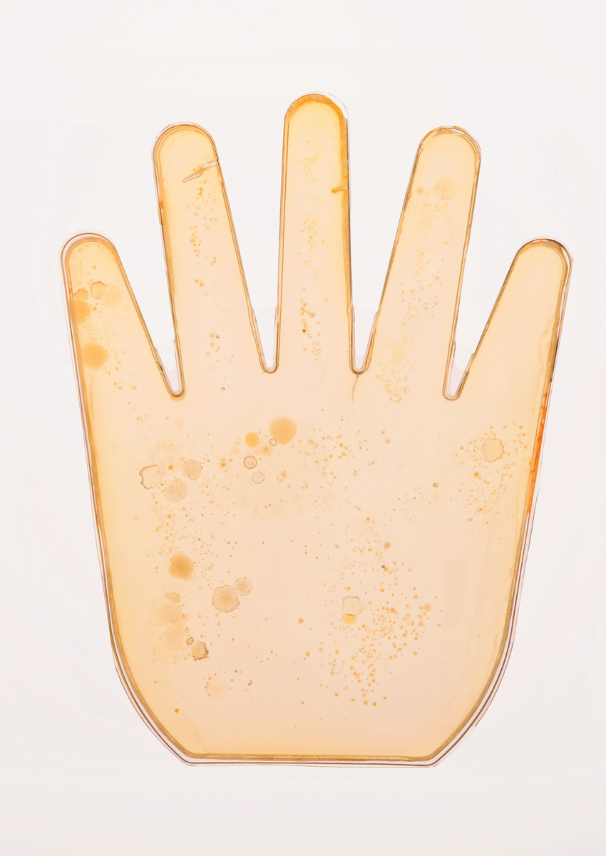 別丁ビジュアル/菌の繁殖した手のオブジェ